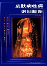 皮膚病性病識別彩圖 /